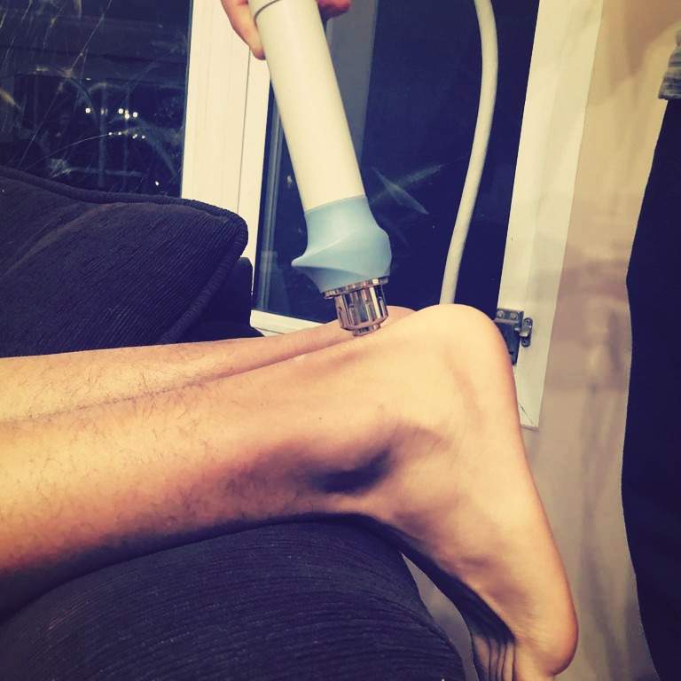 Tendinopatia del Aquiles